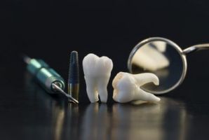 cursos implantologia dental ciudad juarez Clínica Dental Uniden - Américas