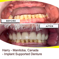 classes correct posture in juarez city Brio Dental